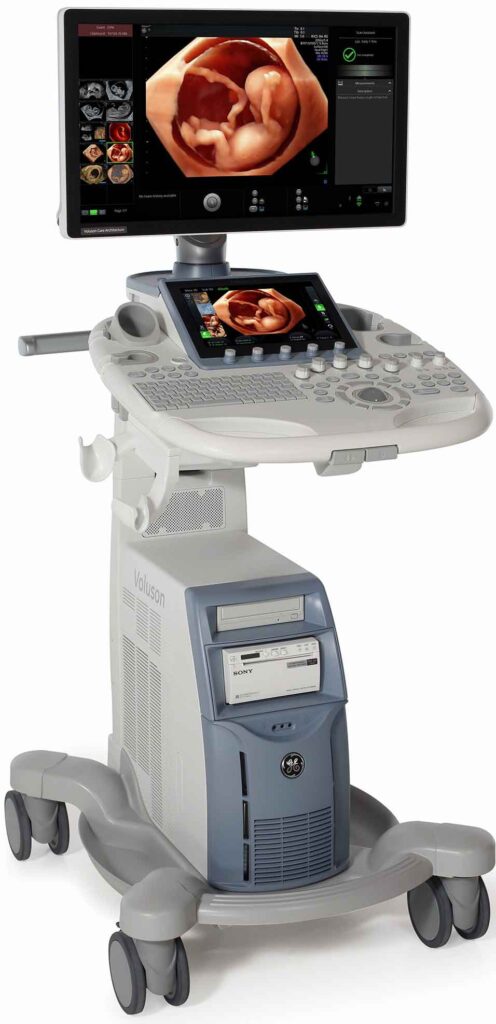 voluson s8 with touch panel ob 1 (1)
